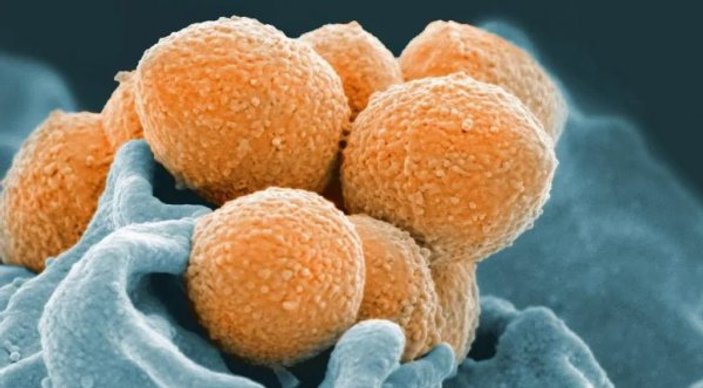 İngiltere'de 12 kişi bakteri yüzünden hayatını kaybetti
