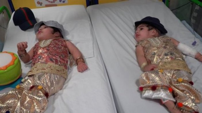 Pakistanlı ikizler 50 saat süren ameliyatla ayrıldı