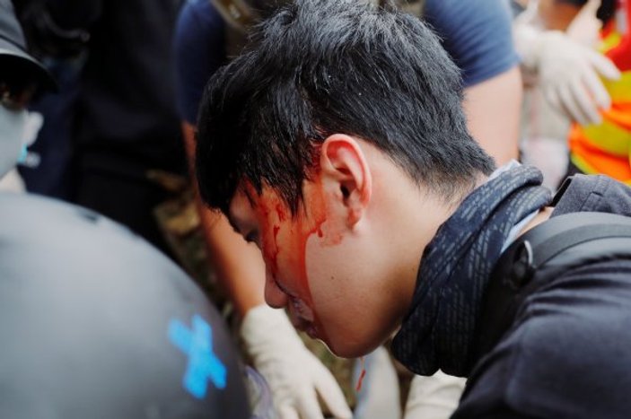 Hong Kong'da polis göstericilere şiddet uyguladı