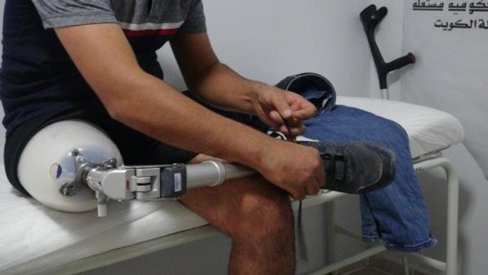 Şanlıurfa'da 590 Suriyeliye protez bacak takıldı