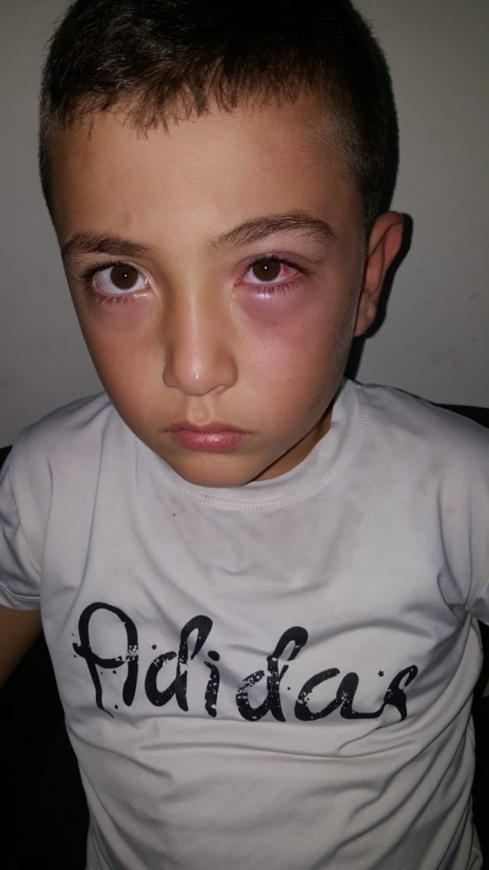Oğluyla tartışan 9 yaşındaki çocuğu yumrukla dövdü