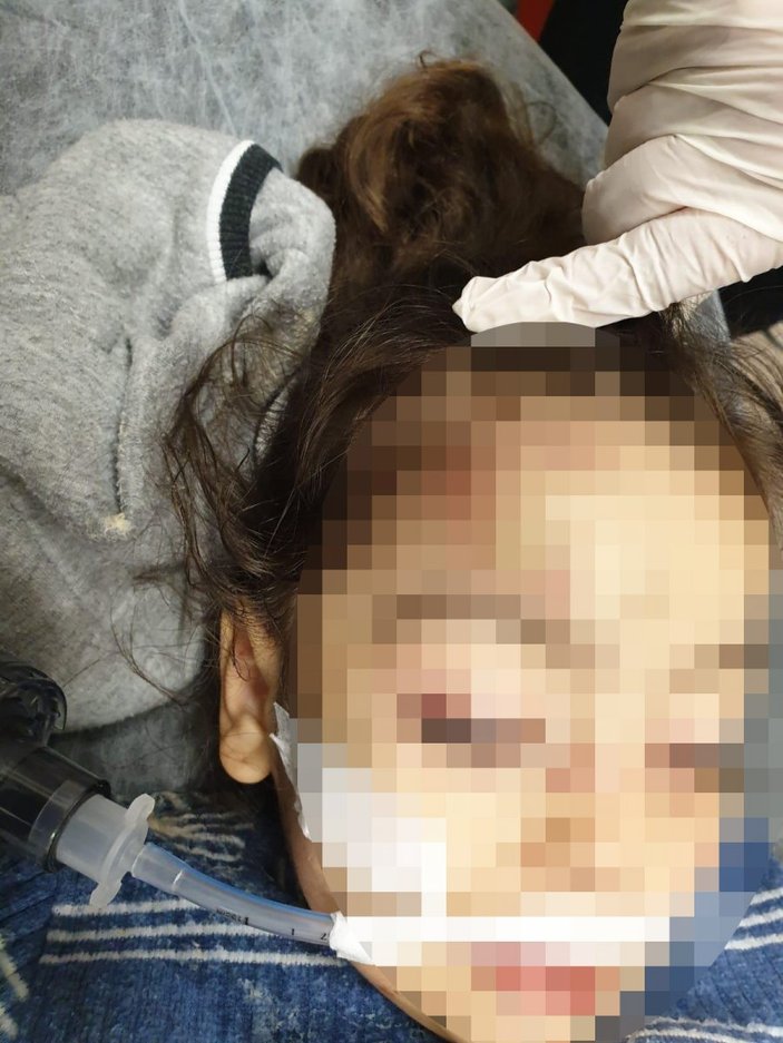 Adana'da üvey anne minik çocuğu öldüresiye dövdü