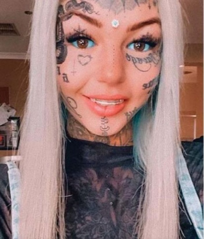 Avustralya'da gözüne dövme yaptıran genç kız kör oluyordu