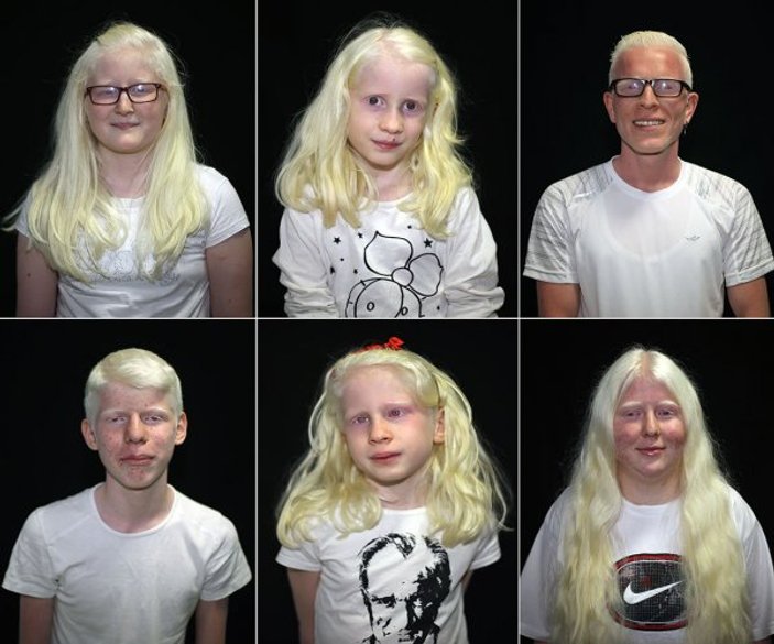Adanalı albinolar, 4 mevsim gölge arıyor