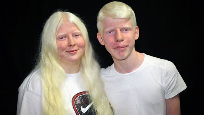 Adanalı albinolar, 4 mevsim gölge arıyor
