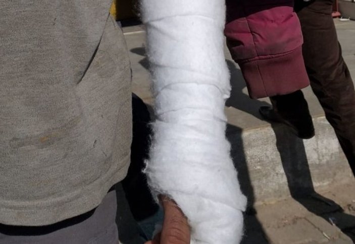 Şanlıurfa'da kaçak elektrik saldırısı: 6 yaralı