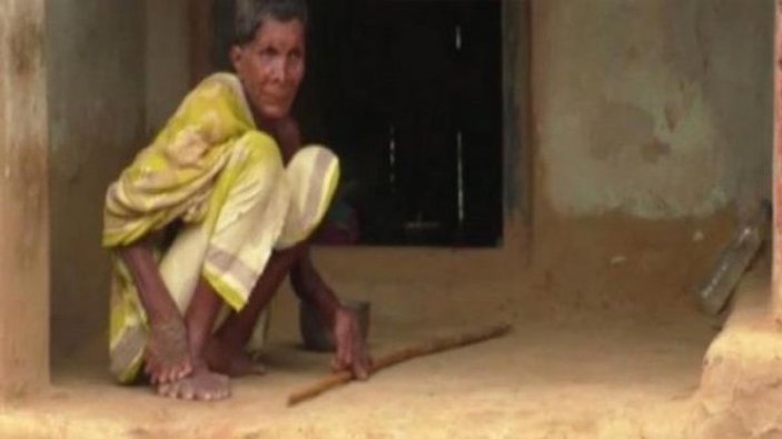 Hindistan'da 32 parmaklı kadını toplum dışladı