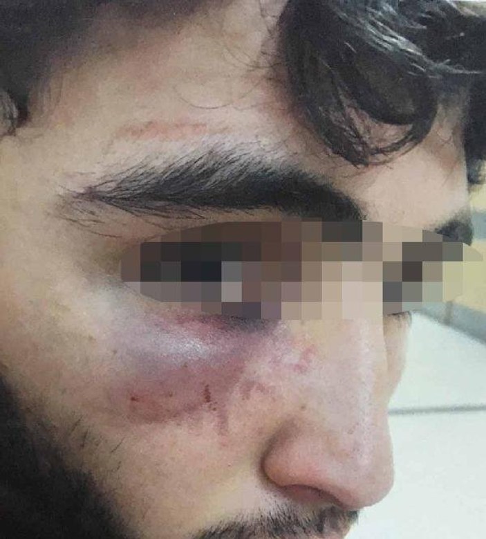 Konya'da 15 yaşındaki çırağa palangalı işkence