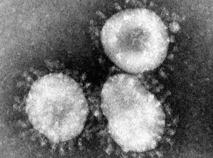 Çin'de SARS'a benzeyen gizemli virüs öldürdü