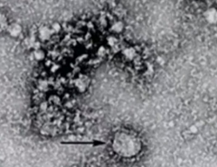Koronovirüsün mikroskopla çekilen görüntüsü yayınlandı