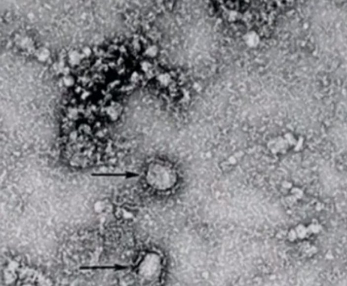 Koronovirüsün mikroskopla çekilen görüntüsü yayınlandı