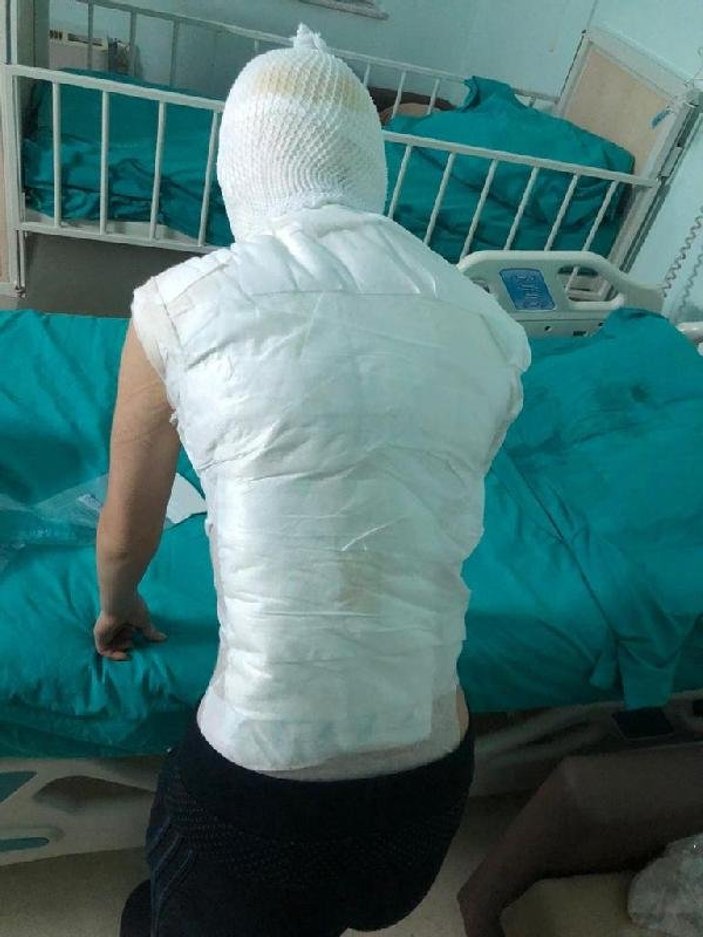 Ümraniye'de üvey anne dehşeti iddiası