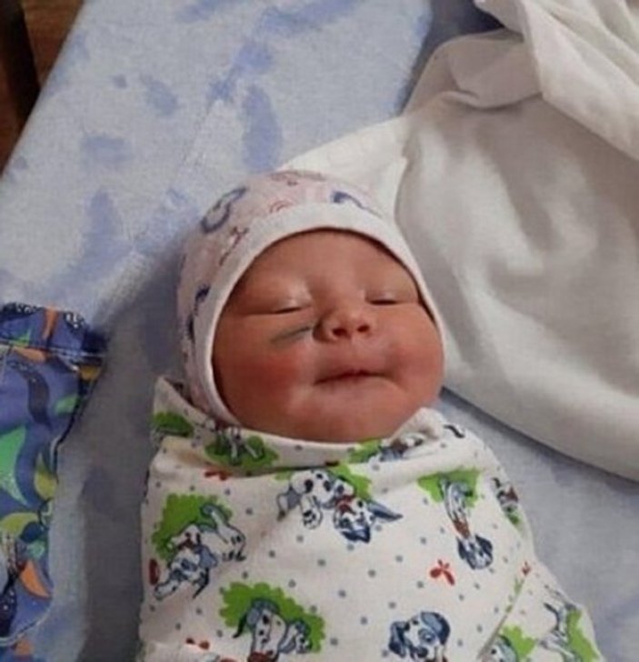 Rusya'da doktorlar doğum sırasında bebeğin yüzünü kesti