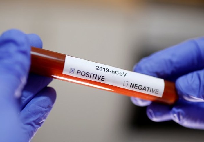 Koronavirüs aşısı en erken 20 ayda hazırlanabilecek