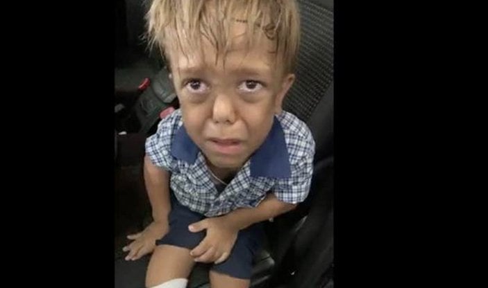 Cüce diye aşağılanan 9 yaşındaki çocuğa ünlülerden destek