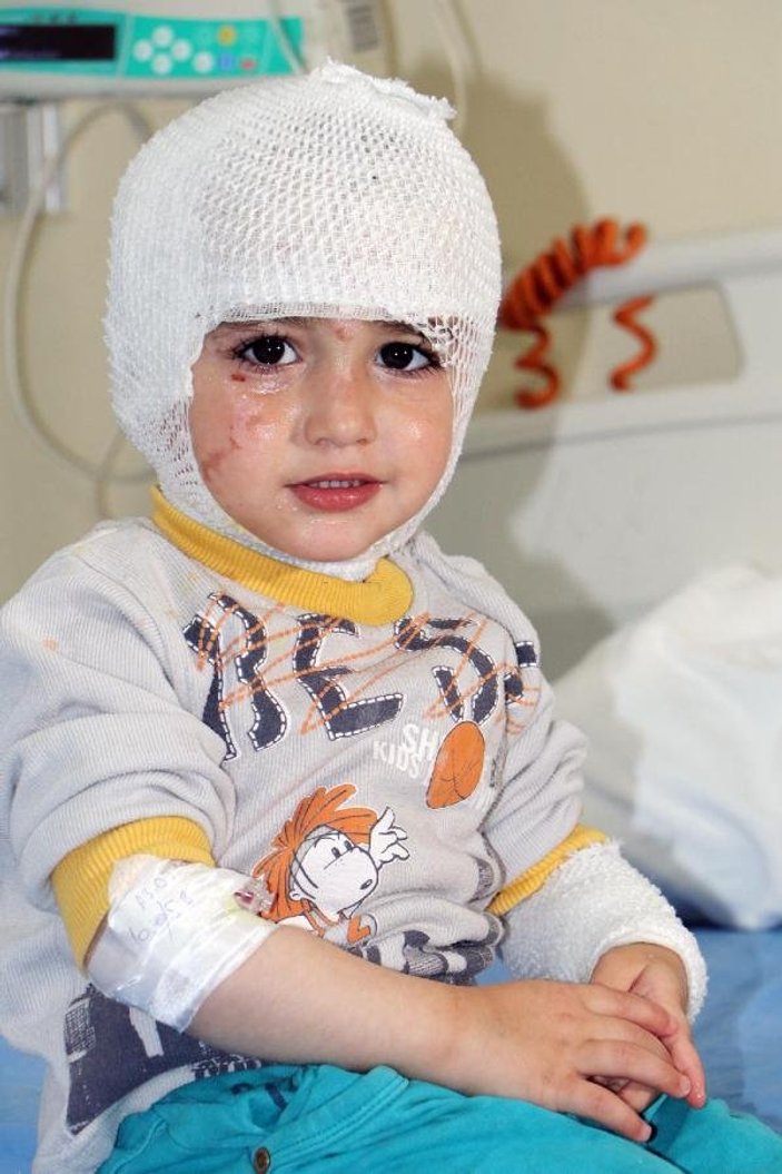 Erzurum'da başına çay dökülen küçük çocuk yandı