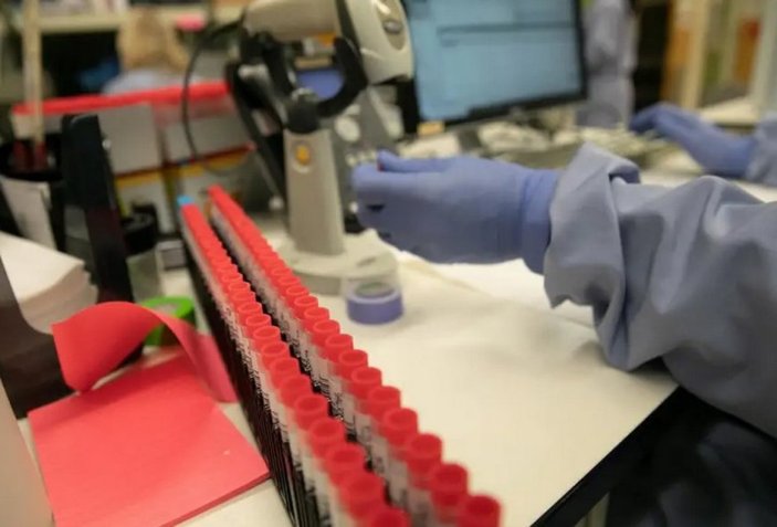 ABD'de ilk koronavirüs aşısı test edilecek