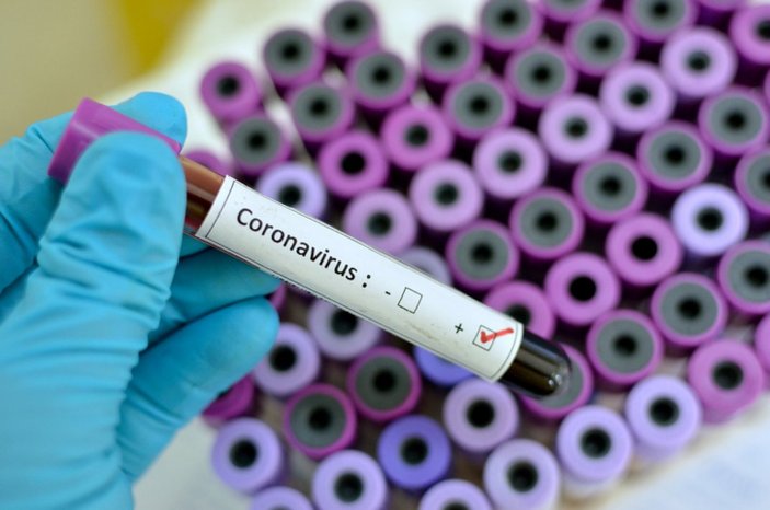 Koronavirüs nedir