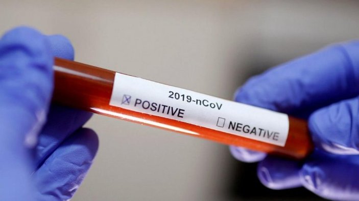 Koronavirüs test sonuçları e-Nabız'da