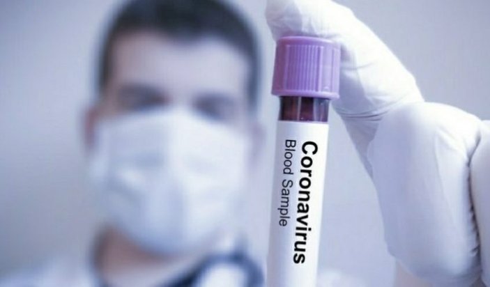 Çekya'da koronavirüsten ilk ölüm
