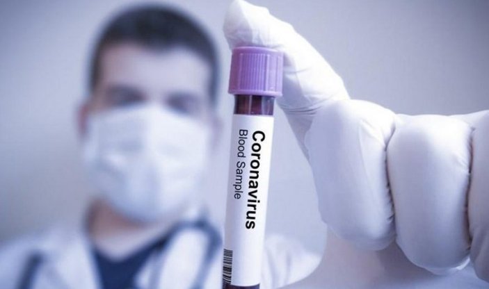 Rus biyomedikal ajansı: Korona ilacını bulduk
