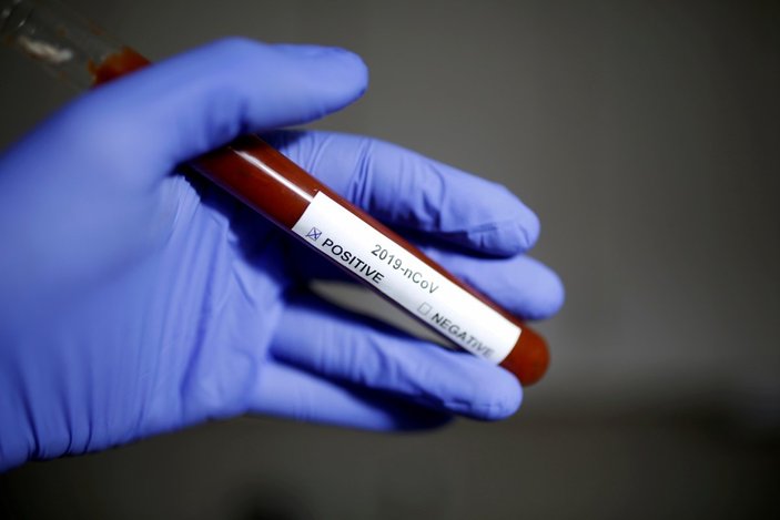 ABD'de 685 bin adet koronavirüs testi yapıldı