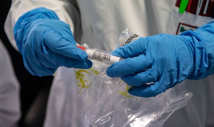 Pittsburgh araştırmacıları: Koronavirüsün aşısını bulduk