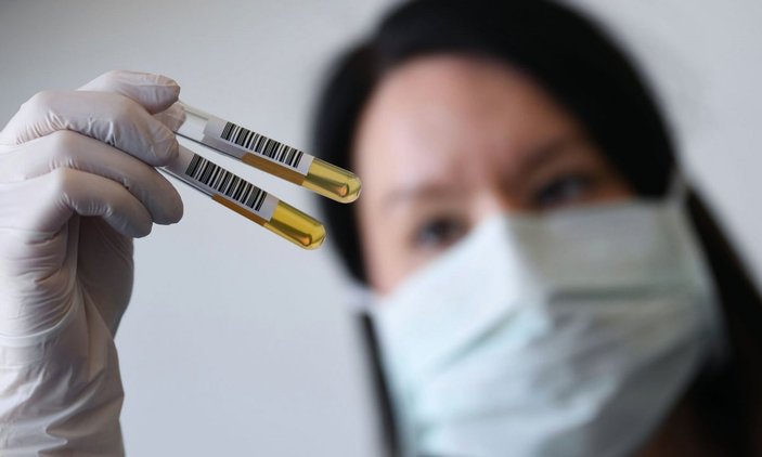 Çin'den koronavirüs tedavisinde plazma müjdesi