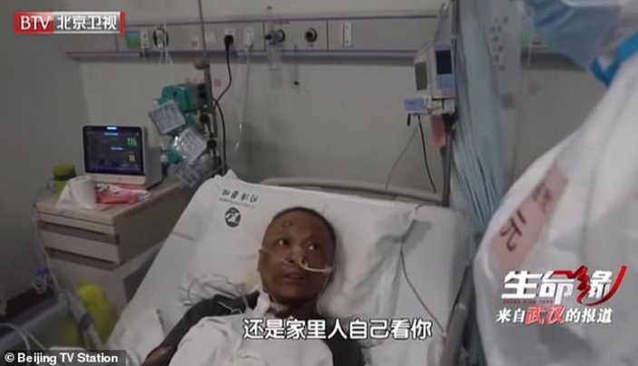 Çin’de koronavirüsü yenen doktorların ten rengi değişti