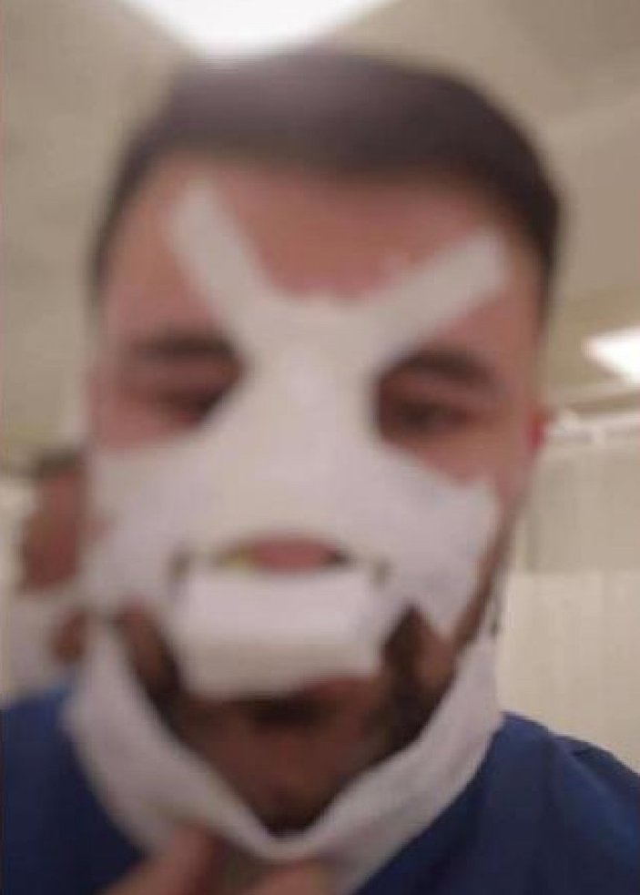 Konya'da sağlık çalışanının burnunu kırdı, serbest kaldı