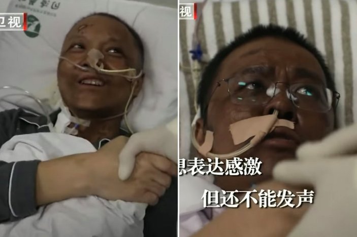 Ten rengi değişen Çinli doktor hayatını kaybetti