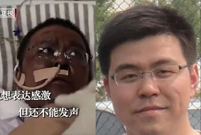 Ten rengi değişen Çinli doktor hayatını kaybetti