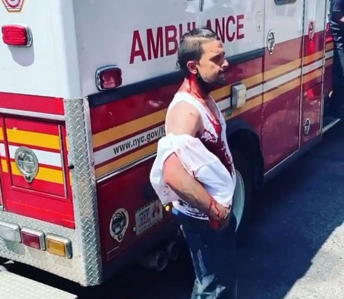 New York'ta bir adam kafasındaki bıçakla sokaklarda gezdi