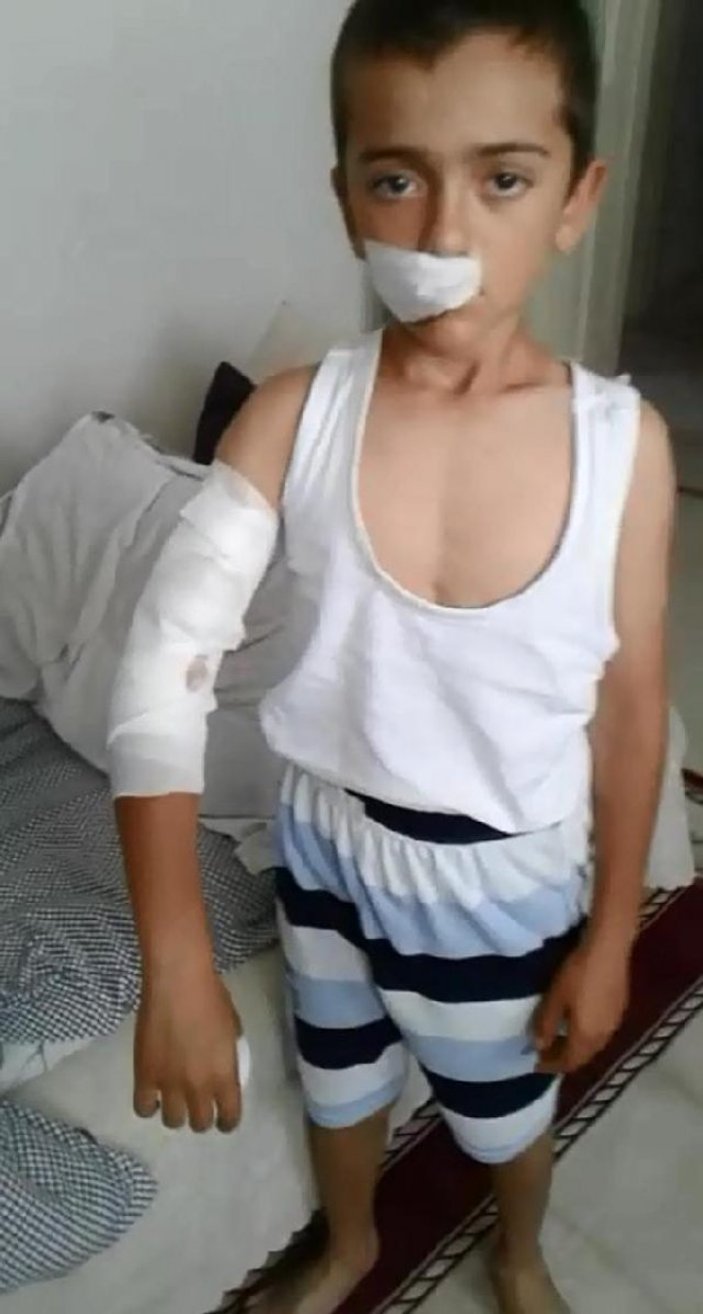 Sultangazi'de 8 yaşındaki Ubeyde'ye köpek saldırdı
