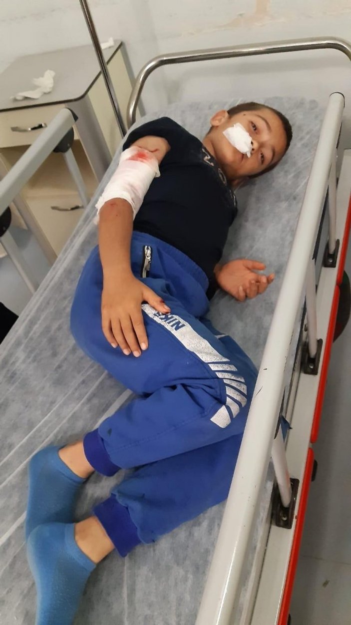 Sultangazi'de 8 yaşındaki Ubeyde'ye köpek saldırdı