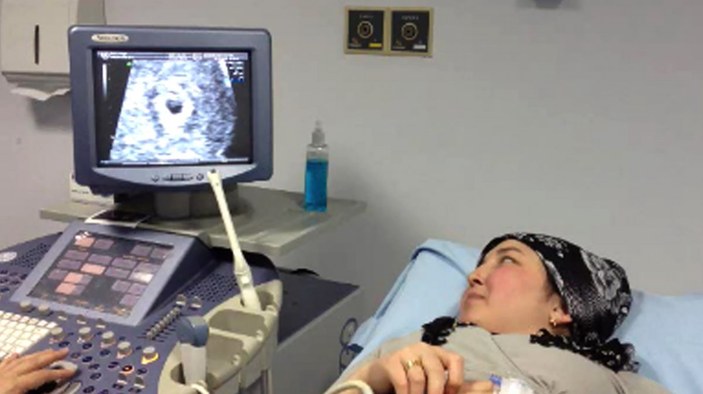 Dünyanın ilk kadavradan rahim nakillisi kadın anne oldu