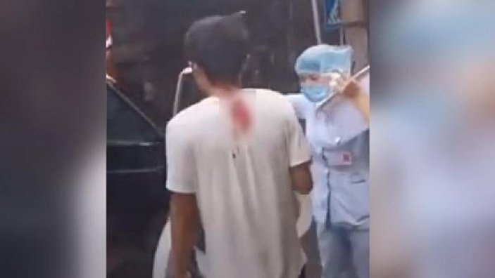 Çin'de kafasına bıçak saplanan adamın sakin tavırları