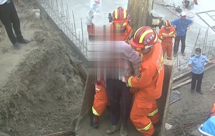 Çin'de demir saplanan inşaat işçisi ölümden döndü