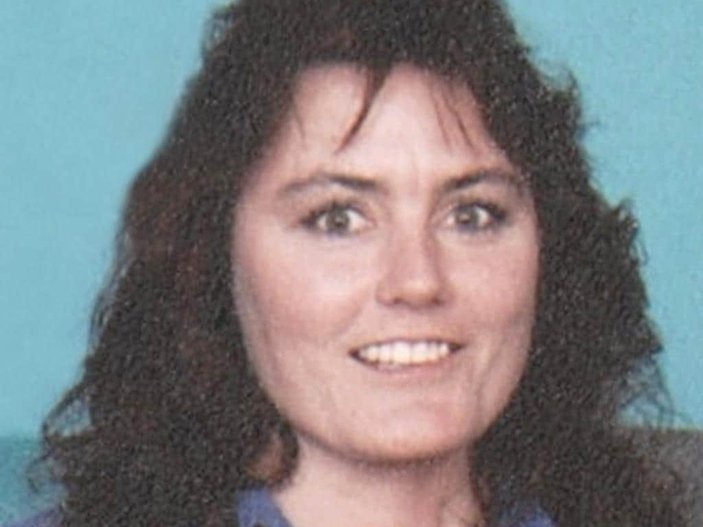 ABD’de ilk yüz nakilli Connie Culp, hayatını kaybetti