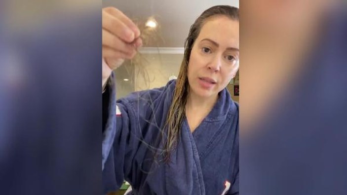 Alyssa Milano’nun koronavirüs sonrası saçları döküldü