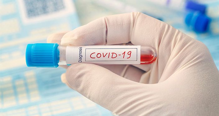 Dünya genelinde koronavirüs vaka sayısı 21 milyonu geçti