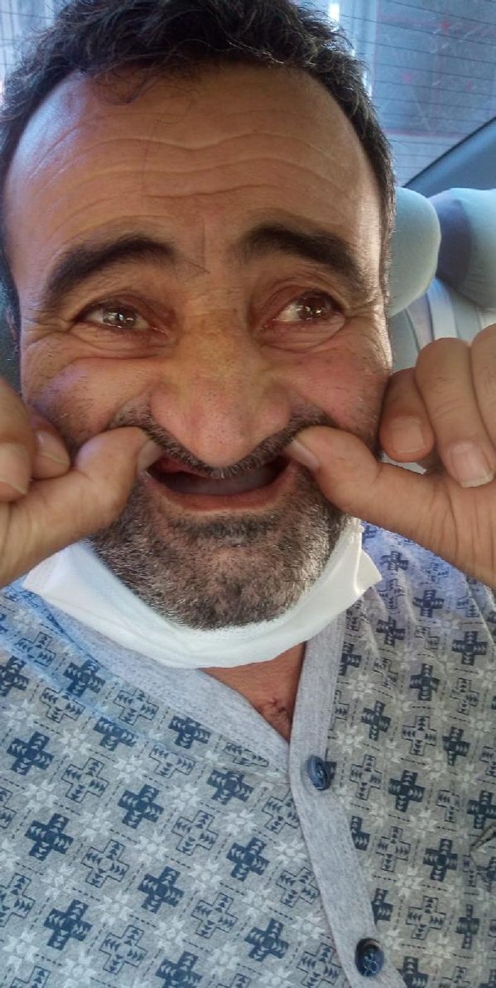 Bursa'da ameliyata girerken teslim ettiği altın dişleri geri gelmedi