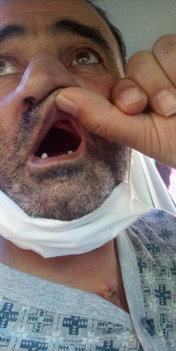 Bursa'da ameliyata girerken teslim ettiği altın dişleri geri gelmedi