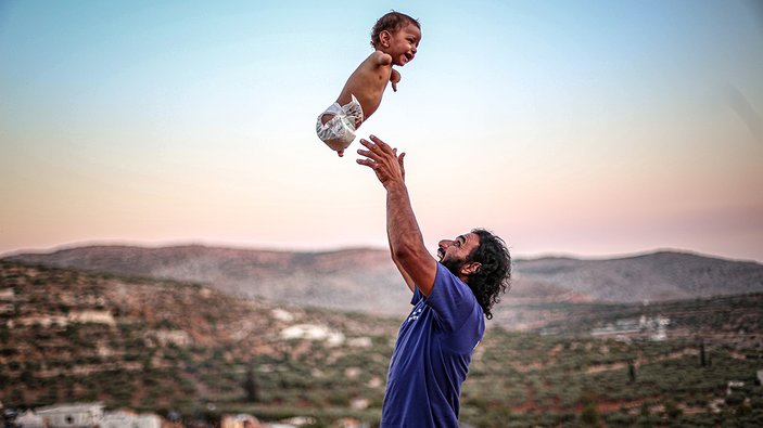 Kolları ve bacakları olmayan Muhammed bebek yardım bekliyor