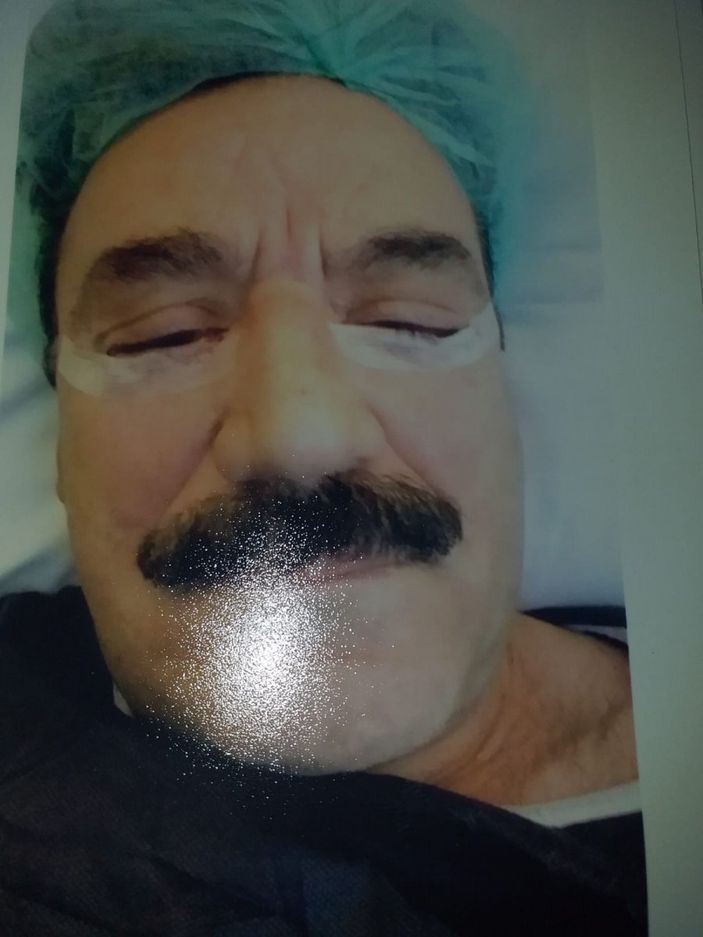 d İstanbul’da ‘göz doktoru hatalı estetik yaptı’ iddiası