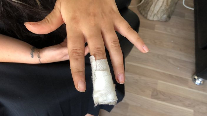 Sinop'ta sandalyeye eli sıkışan kadının parmağı koptu