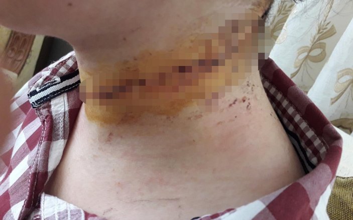 Kayseri'de gözü dönmüş adam, boğazını kestiği eşini boğmaya çalıştı