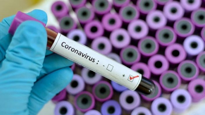D vitamininin, koronavirüs riskini azalttığı saptandı