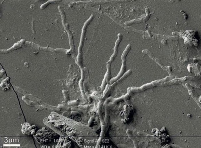 İtalya’da 2 bin yıl önceye ait kafatasından sağlam beyin hücresi keşfedildi