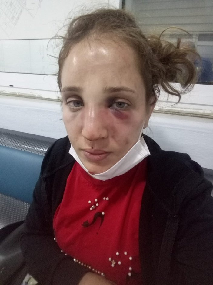 Aydın'da kocasından şiddet gören genç kadın yardım istiyor